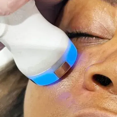 Radiofrecuencia DUAL PRO – Facial Contorno de los ojos (45min)